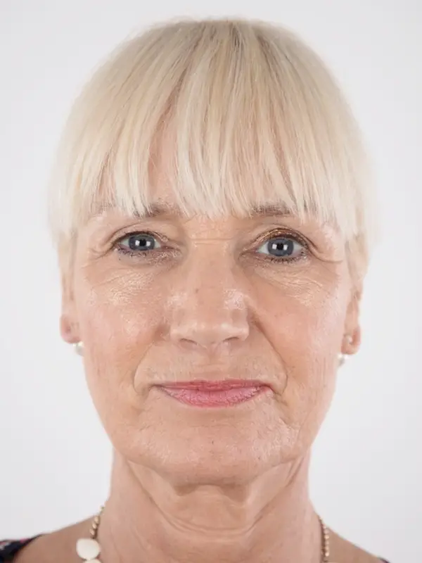 Kontaktanzeige Bild